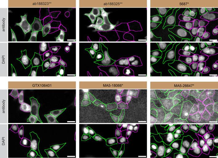 https://cdn.ncbi.nlm.nih.gov/pmc/blobs/7e99/11811697/7fbde8be4312/f1000research-13-168890-g0002.jpg