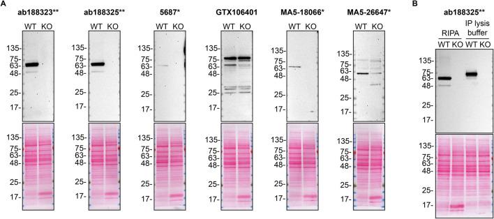 https://cdn.ncbi.nlm.nih.gov/pmc/blobs/7e99/11811697/c8d29e8cd44c/f1000research-13-168890-g0000.jpg