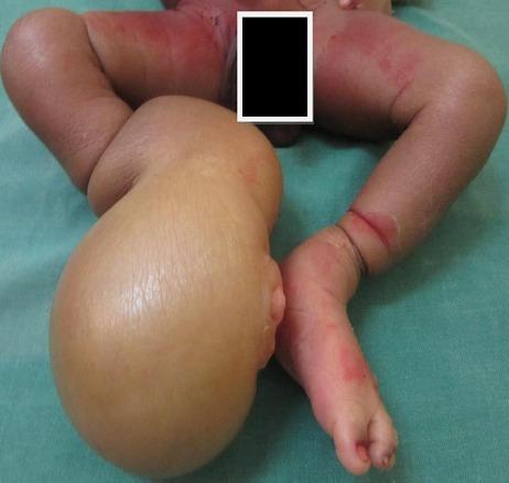https://cdn.ncbi.nlm.nih.gov/pmc/blobs/7e9c/4752845/29cd0d7a35ca/PAMJ-22-187-g005.jpg