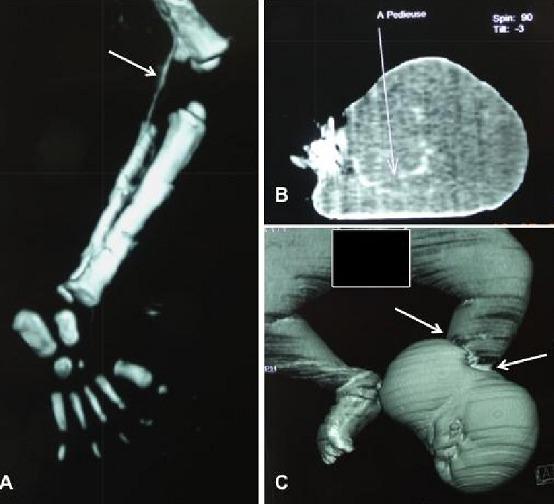 https://cdn.ncbi.nlm.nih.gov/pmc/blobs/7e9c/4752845/84b0a2af4a34/PAMJ-22-187-g001.jpg