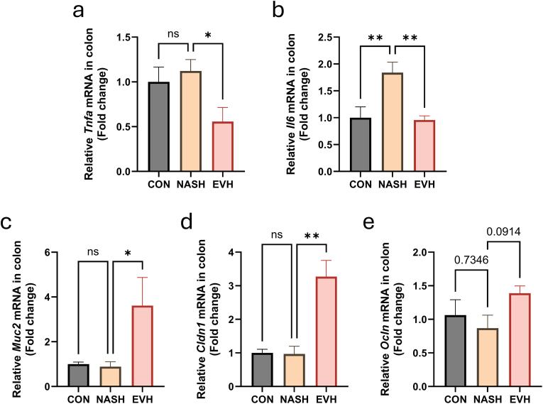 https://cdn.ncbi.nlm.nih.gov/pmc/blobs/7ea2/11995039/152ea7ae1e07/gr11.jpg