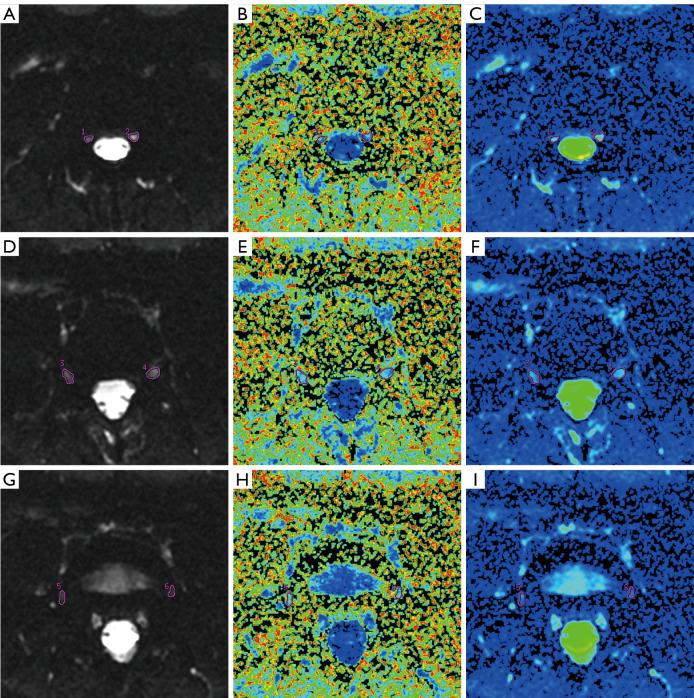 https://cdn.ncbi.nlm.nih.gov/pmc/blobs/7ea6/9511419/2698042858f0/qims-12-10-4875-f3.jpg