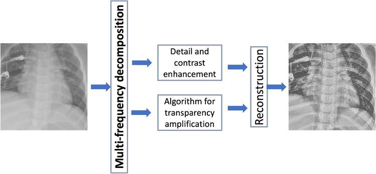 https://cdn.ncbi.nlm.nih.gov/pmc/blobs/7eb9/9107410/713b5da889e2/247_2021_5279_Fig2_HTML.jpg