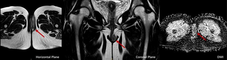 https://cdn.ncbi.nlm.nih.gov/pmc/blobs/7ebc/12185280/f422d9df8931/fonc-15-1577068-g003.jpg