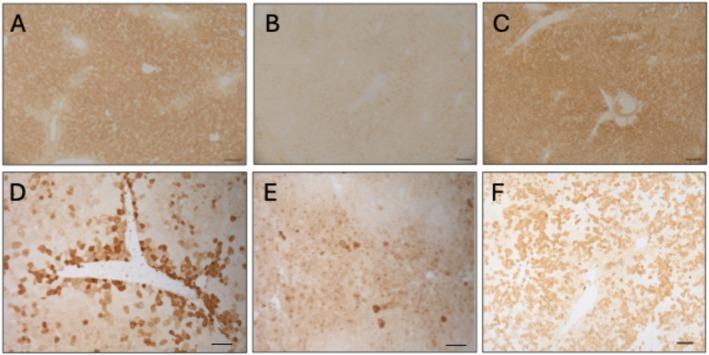 https://cdn.ncbi.nlm.nih.gov/pmc/blobs/7ebd/12361847/90d6b36e35d6/JIMD-48-0-g003.jpg