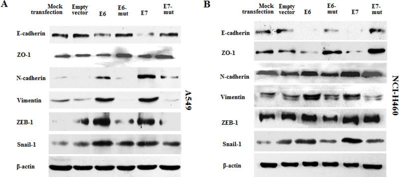 https://cdn.ncbi.nlm.nih.gov/pmc/blobs/7ebd/7841029/254b41d74532/OR-25-843-g004.jpg