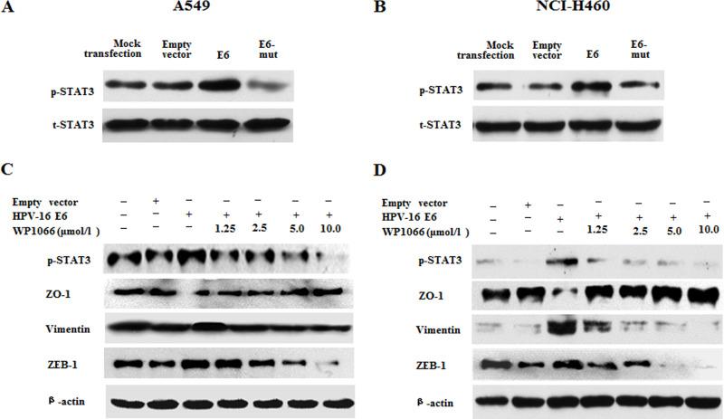 https://cdn.ncbi.nlm.nih.gov/pmc/blobs/7ebd/7841029/ffcc12ec96fd/OR-25-843-g006.jpg