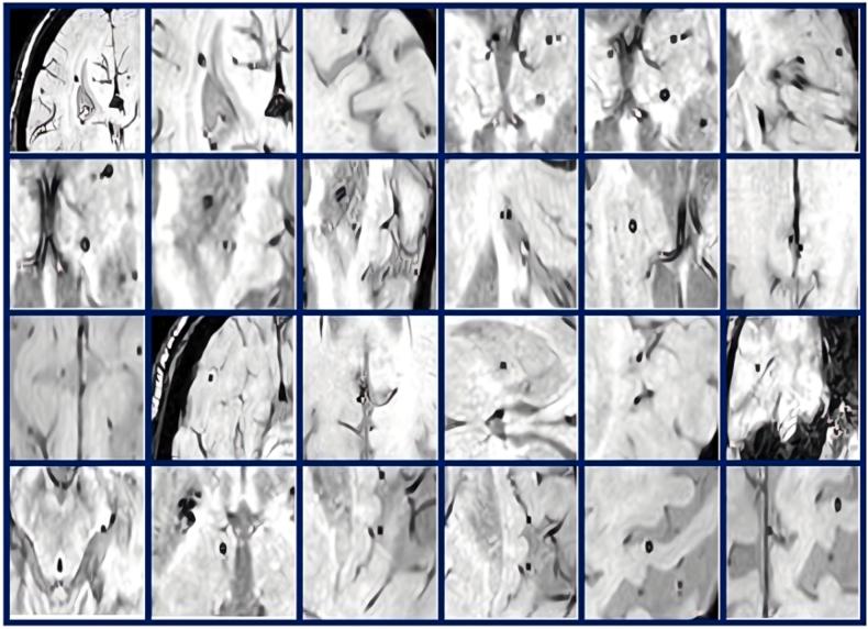 https://cdn.ncbi.nlm.nih.gov/pmc/blobs/7ebf/10731074/0bc184cf3744/gr4.jpg