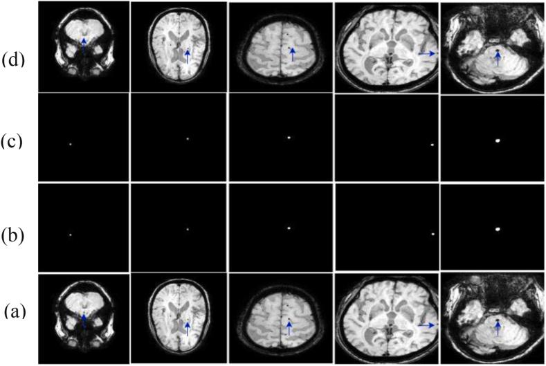 https://cdn.ncbi.nlm.nih.gov/pmc/blobs/7ebf/10731074/757d398cf7ac/gr6.jpg