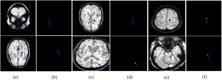 https://cdn.ncbi.nlm.nih.gov/pmc/blobs/7ebf/10731074/a2c067fbbe1e/gr2.jpg