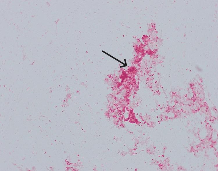 https://cdn.ncbi.nlm.nih.gov/pmc/blobs/7ec3/12004031/231e9fad40f8/cureus-0017-00000080747-i04.jpg