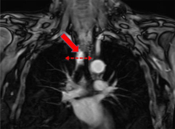 https://cdn.ncbi.nlm.nih.gov/pmc/blobs/7ed3/6180863/20cf1ce03e18/bjrcr.20150201.g001.jpg
