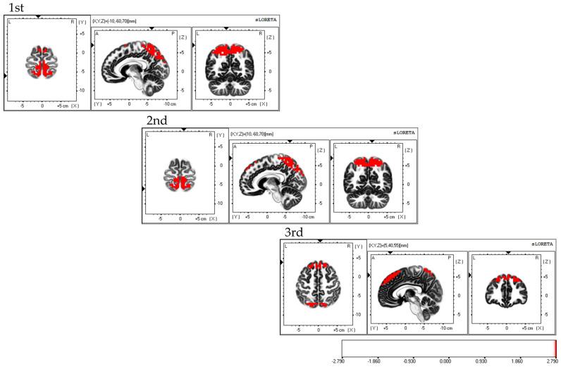 https://cdn.ncbi.nlm.nih.gov/pmc/blobs/7ed4/10526995/c28a3b022bbf/brainsci-13-01237-g005.jpg
