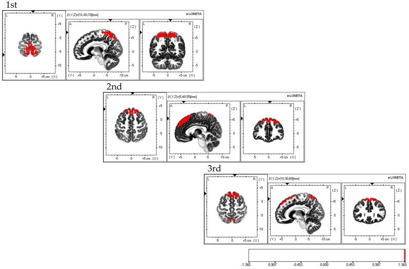 https://cdn.ncbi.nlm.nih.gov/pmc/blobs/7ed4/10526995/ef4fd4b0a720/brainsci-13-01237-g006.jpg