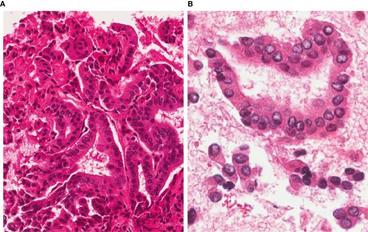 https://cdn.ncbi.nlm.nih.gov/pmc/blobs/7ed6/8040516/261220eb913e/fendo-12-566362-g001.jpg