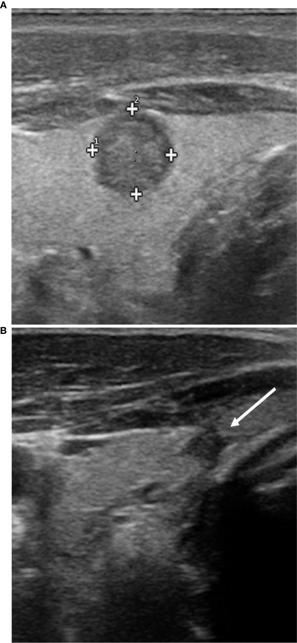 https://cdn.ncbi.nlm.nih.gov/pmc/blobs/7ed6/8040516/26676ec50eaf/fendo-12-566362-g002.jpg