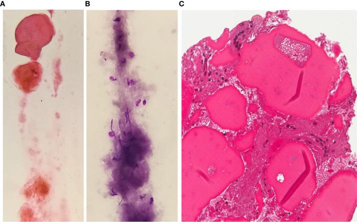 https://cdn.ncbi.nlm.nih.gov/pmc/blobs/7ed6/8040516/7e8e29075713/fendo-12-566362-g003.jpg