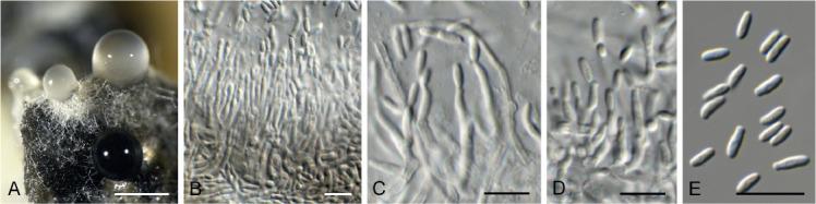 https://cdn.ncbi.nlm.nih.gov/pmc/blobs/7ed9/7452156/2c6f4599b120/fuse-2020-6-9-g026.jpg