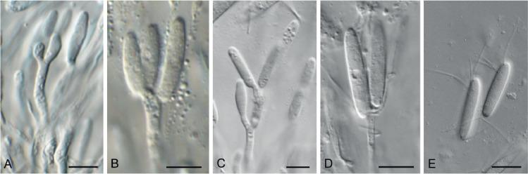 https://cdn.ncbi.nlm.nih.gov/pmc/blobs/7ed9/7452156/310ffc5f1d35/fuse-2020-6-9-g014.jpg