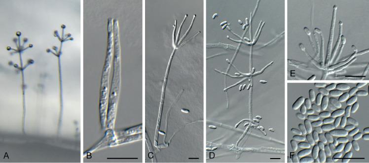 https://cdn.ncbi.nlm.nih.gov/pmc/blobs/7ed9/7452156/4a927903d710/fuse-2020-6-9-g025.jpg