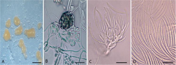 https://cdn.ncbi.nlm.nih.gov/pmc/blobs/7ed9/7452156/5a00d4143d9c/fuse-2020-6-9-g021.jpg
