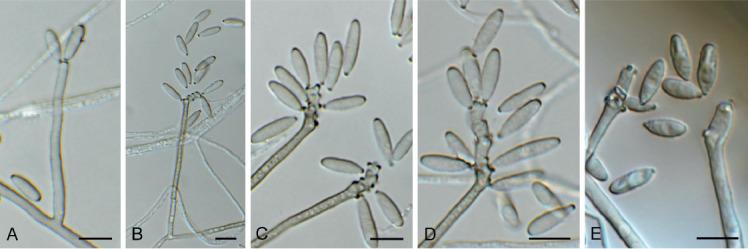 https://cdn.ncbi.nlm.nih.gov/pmc/blobs/7ed9/7452156/764ba0cd5eee/fuse-2020-6-9-g023.jpg