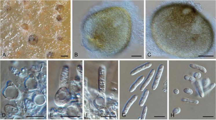 https://cdn.ncbi.nlm.nih.gov/pmc/blobs/7ed9/7452156/abef6d1ae4ef/fuse-2020-6-9-g034.jpg