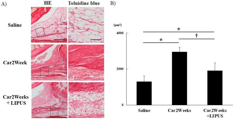 https://cdn.ncbi.nlm.nih.gov/pmc/blobs/7eda/11134478/1f41a71c7f3c/cureus-0016-00000059246-i04.jpg