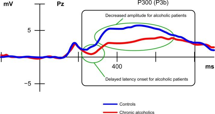 https://cdn.ncbi.nlm.nih.gov/pmc/blobs/7ee0/3849081/a518cd4a37c2/ndt-9-1835Fig2.jpg
