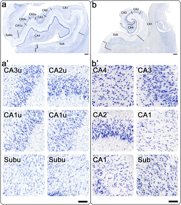 https://cdn.ncbi.nlm.nih.gov/pmc/blobs/7ee6/10090178/c752bac8813c/41598_2023_32903_Fig1_HTML.jpg