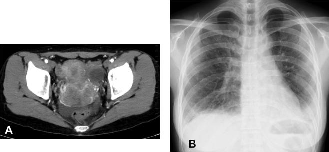 https://cdn.ncbi.nlm.nih.gov/pmc/blobs/7eee/5153447/637c289c02ee/gr1.jpg