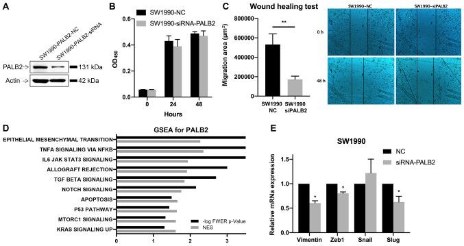 https://cdn.ncbi.nlm.nih.gov/pmc/blobs/7eee/7856690/1618df904cda/ol-21-03-12485-g06.jpg