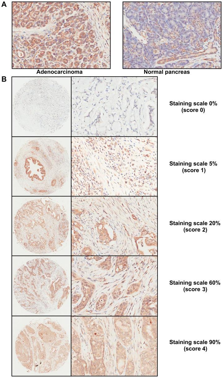 https://cdn.ncbi.nlm.nih.gov/pmc/blobs/7eee/7856690/b218822d44b2/ol-21-03-12485-g00.jpg