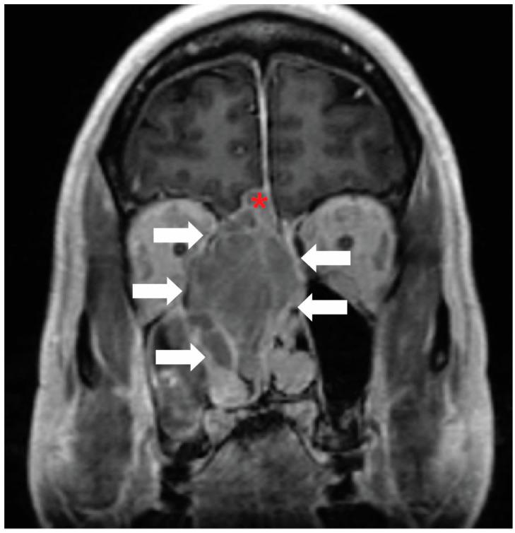 https://cdn.ncbi.nlm.nih.gov/pmc/blobs/7ef2/11546070/a8db8573dc25/jcm-13-06295-g002.jpg