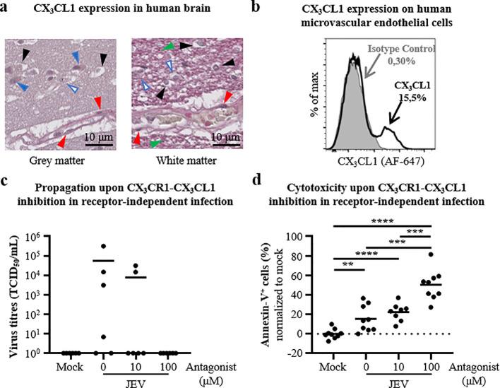 https://cdn.ncbi.nlm.nih.gov/pmc/blobs/7ef3/12081440/6a71f2d2d5c6/fcimb-15-1580958-g003.jpg