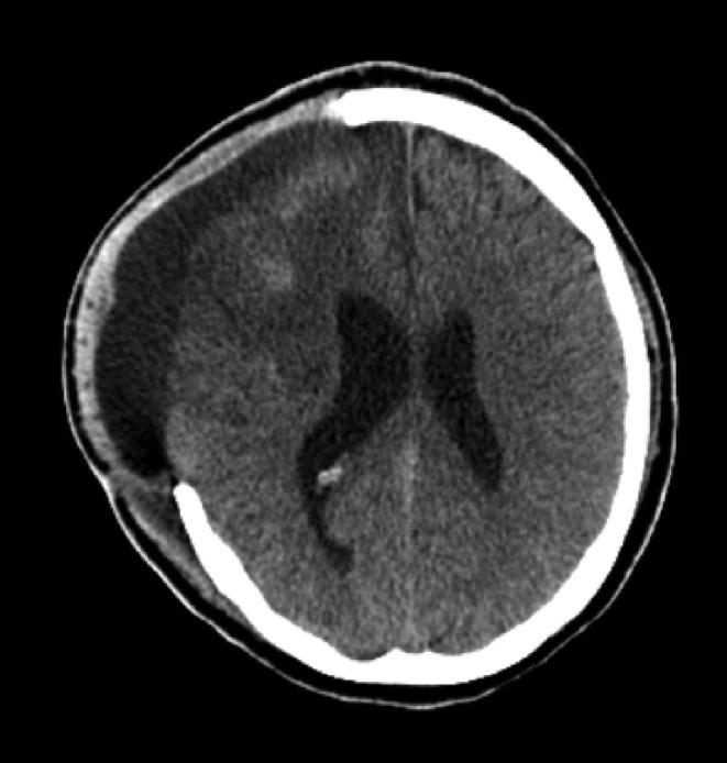 https://cdn.ncbi.nlm.nih.gov/pmc/blobs/7efa/11299070/76f7c48ddafa/CCR3-12-e9254-g001.jpg