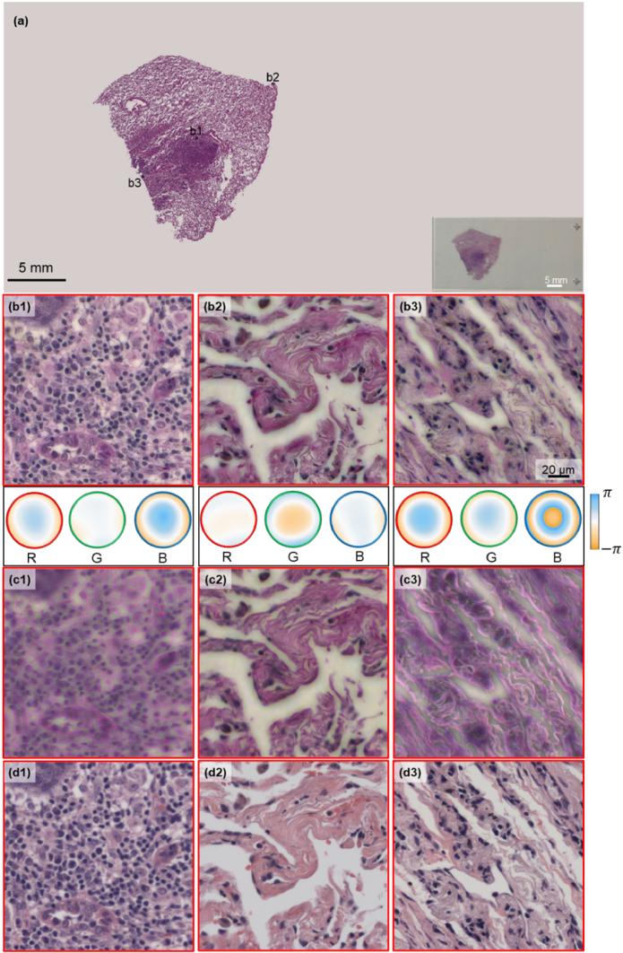 https://cdn.ncbi.nlm.nih.gov/pmc/blobs/7efb/11482188/15cbeb790d2e/boe-15-10-5739-g005.jpg