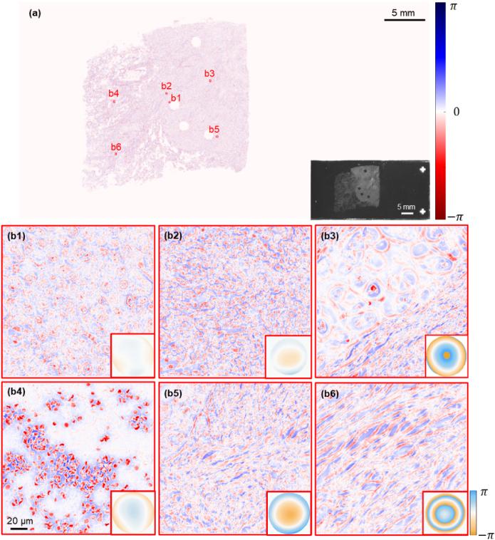 https://cdn.ncbi.nlm.nih.gov/pmc/blobs/7efb/11482188/f013493ccfd4/boe-15-10-5739-g004.jpg