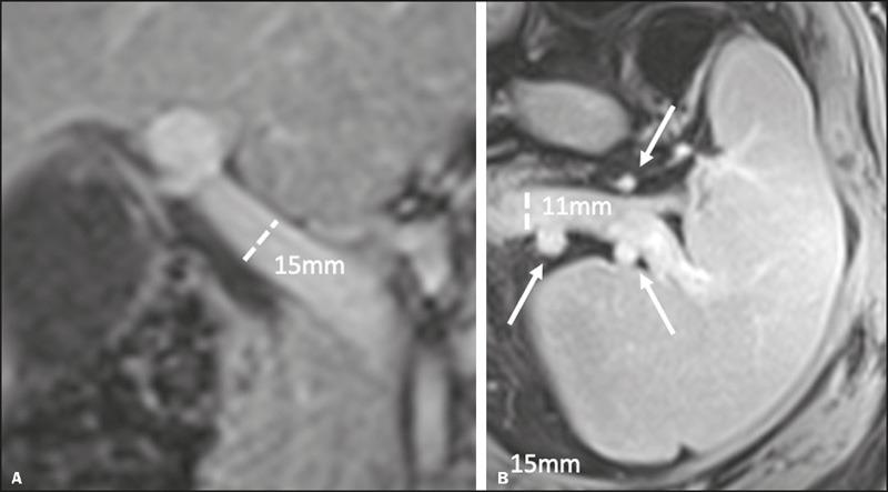 https://cdn.ncbi.nlm.nih.gov/pmc/blobs/7efc/10948163/1b8a8434efaa/rb-56-06-0308-g02.jpg
