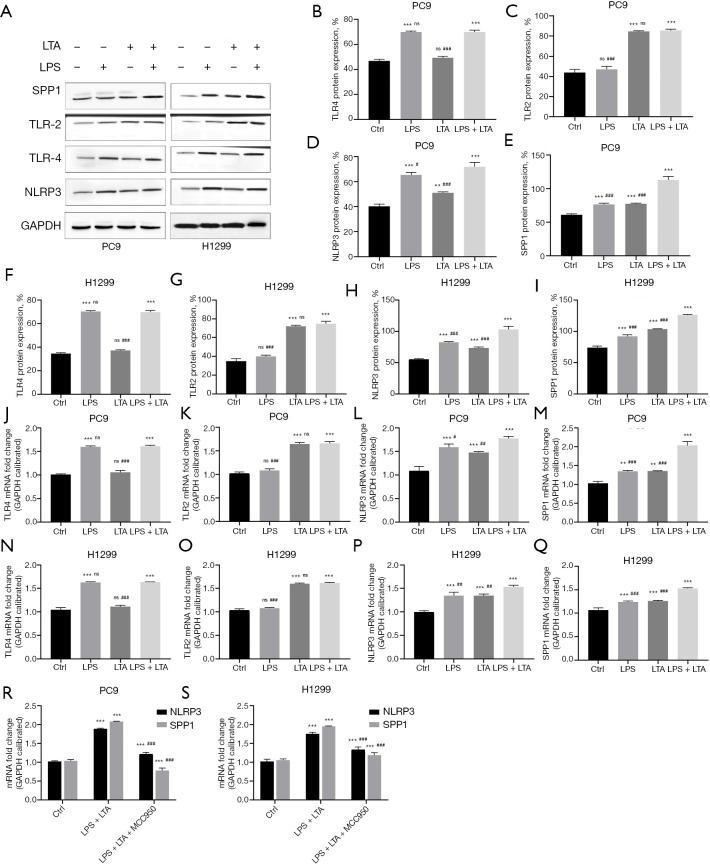 https://cdn.ncbi.nlm.nih.gov/pmc/blobs/7efc/9922606/4b9872cdd5e0/jtd-15-01-168-f5.jpg