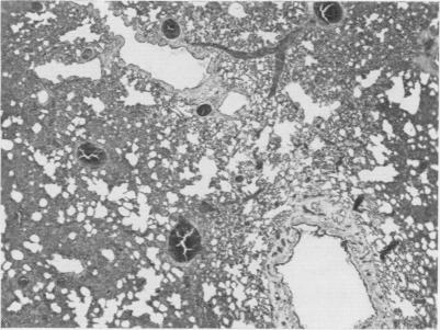 https://cdn.ncbi.nlm.nih.gov/pmc/blobs/7f02/1465952/47a79d91e090/annsurg00859-0058-a.jpg