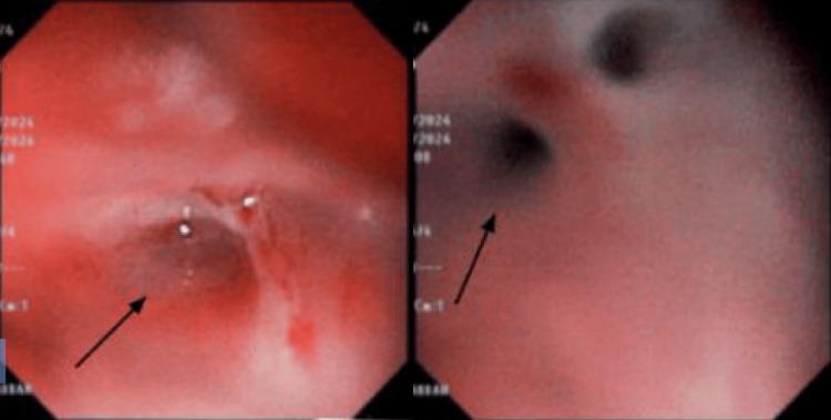 https://cdn.ncbi.nlm.nih.gov/pmc/blobs/7f0f/11684546/119998b631b6/cureus-0016-00000074819-i03.jpg