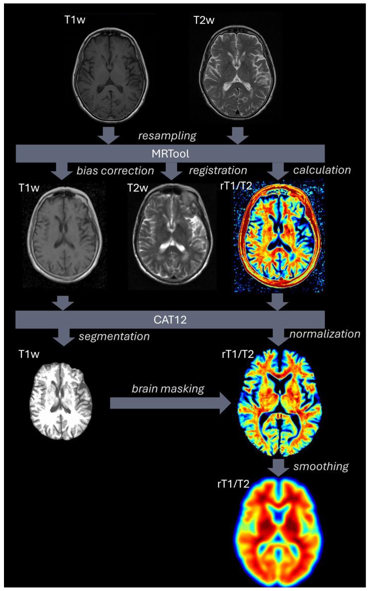 https://cdn.ncbi.nlm.nih.gov/pmc/blobs/7f15/12072834/95417ec2e265/jcm-14-02888-g004.jpg