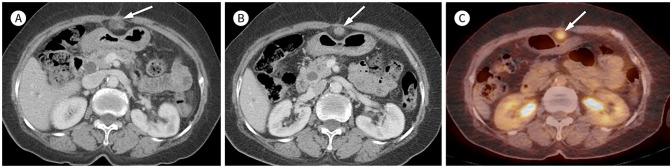 https://cdn.ncbi.nlm.nih.gov/pmc/blobs/7f18/10864145/eb17f9ee1bd6/jksr-85-109-g005.jpg