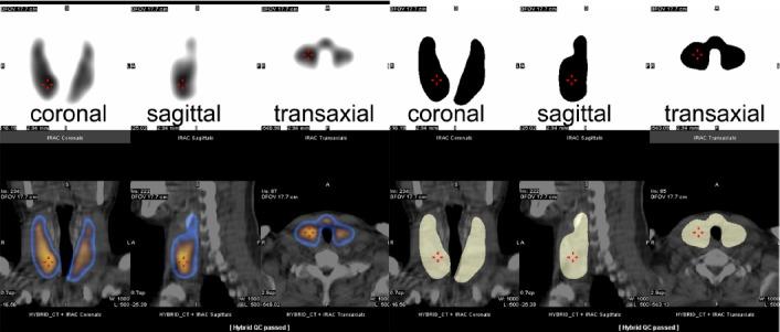 https://cdn.ncbi.nlm.nih.gov/pmc/blobs/7f1f/5221685/02e185eaa8b3/AOJNMB-5-44-g002.jpg