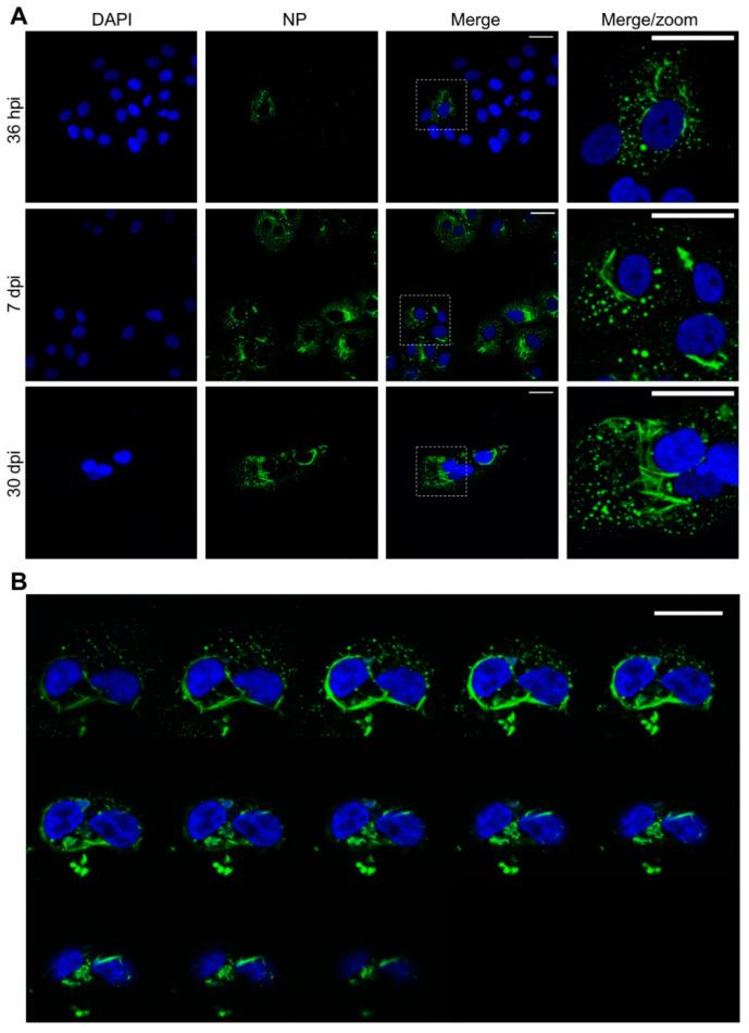 https://cdn.ncbi.nlm.nih.gov/pmc/blobs/7f24/7408811/63b0de432aa5/cells-09-01569-g001.jpg