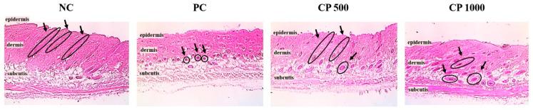 https://cdn.ncbi.nlm.nih.gov/pmc/blobs/7f2c/9569759/4263fe3e3c6a/ijms-23-11904-g004.jpg