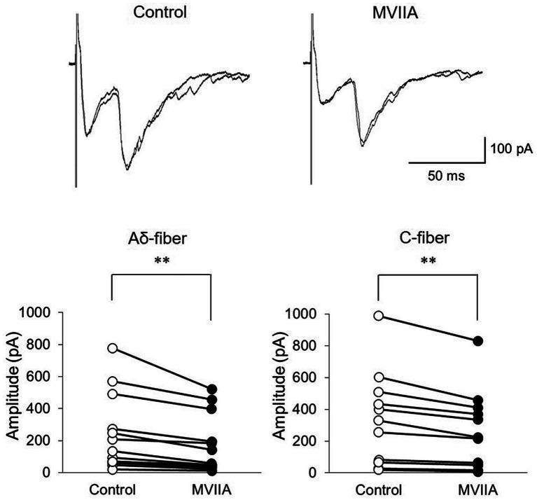 https://cdn.ncbi.nlm.nih.gov/pmc/blobs/7f35/10925679/c427b1a42a88/fnins-18-1366829-g006.jpg