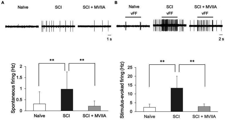 https://cdn.ncbi.nlm.nih.gov/pmc/blobs/7f35/10925679/db7c84d7af4d/fnins-18-1366829-g003.jpg