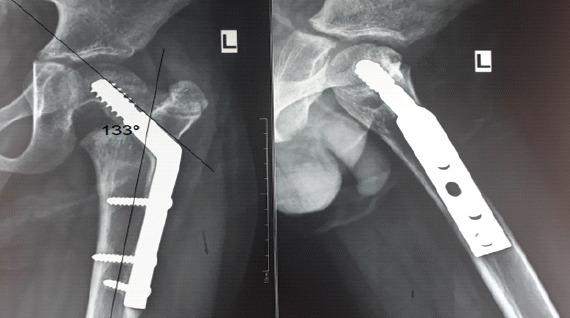 https://cdn.ncbi.nlm.nih.gov/pmc/blobs/7f3b/12328956/2d104d2d4bdb/JOCR-15-201-g006.jpg